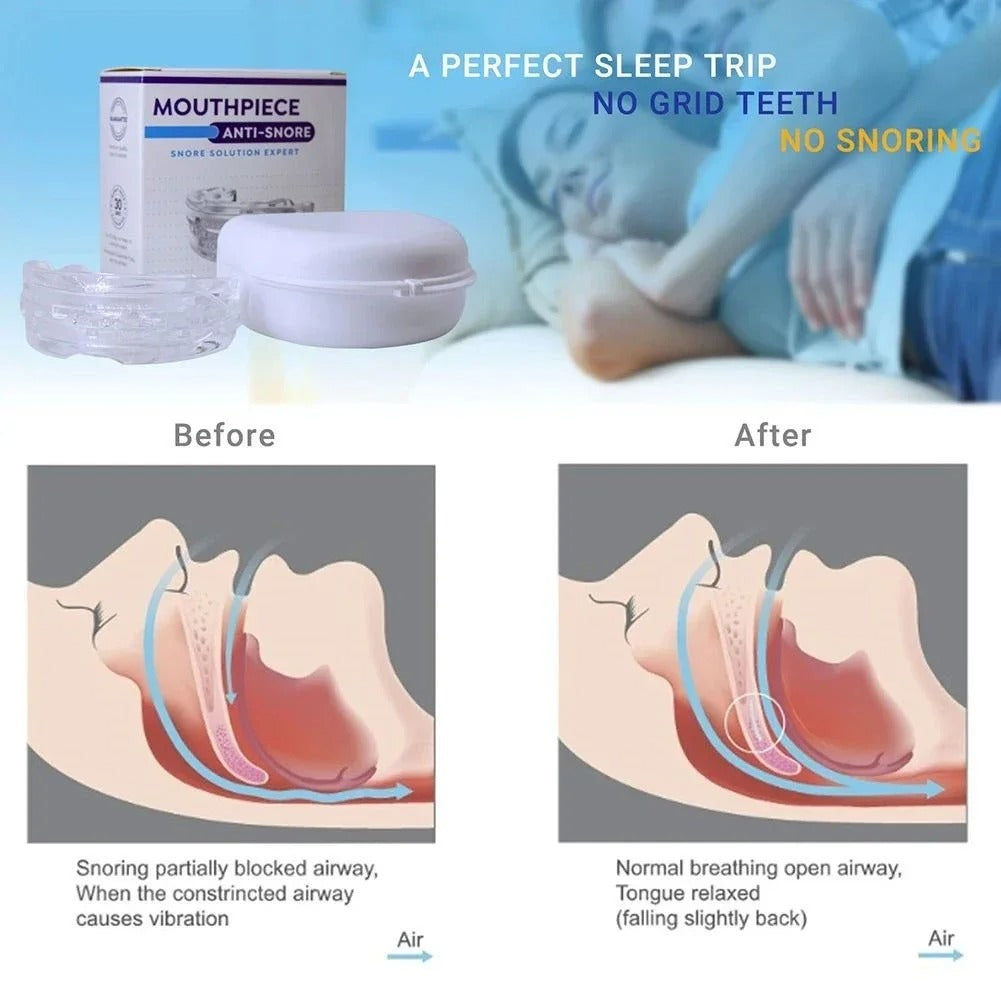 Zentara SleepQuiet™  Anti-Snore Mouthpiece